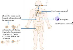 نقش محور روده-کبد-ریه در بیماری مزمن انسدادی ریه (COPD)