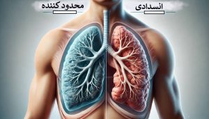 بیماری ریوی محدودکننده